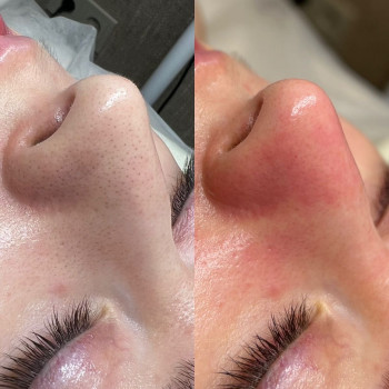 Софія Пелих, Ізюм Фото - 7