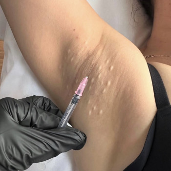 Софія Пелих, Ізюм Фото - 8