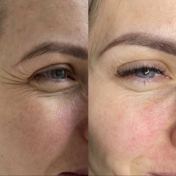 Софія Пелих, Ізюм Фото - 10