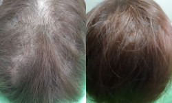  Косметолог-эстетист  Ивано-Франковск