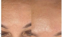  Косметолог-эстетист  Ивано-Франковск