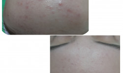  Косметолог-естетист  Івано-Франківськ