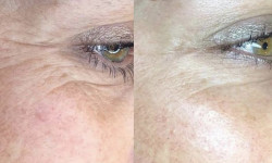  Косметолог-эстетист  Ивано-Франковск