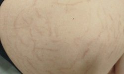 Омолодження обличчя Майстер депіляції Аліна Кам'янське