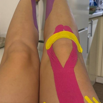 Тейпування