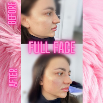 Ірина Кузь, Львов Фото - 2