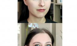  Бровіст  Житомир