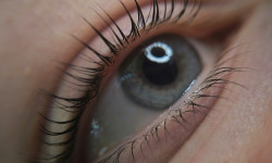  Бровіст  Житомир