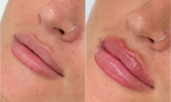  Косметолог Лілія Ровно