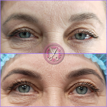 Иленто, Запорожье Фото - 5