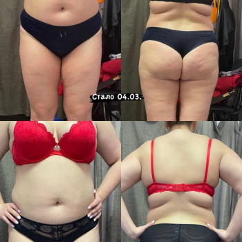 Іспанська професійна косметика 
Гипоалергенна