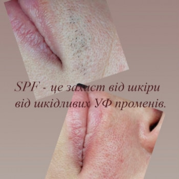 Валентина , Хмельницкий Фото - 5