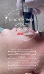 Мікронідлінг  зі знижкою 33% Косметологический центр Perfect Skin Киев