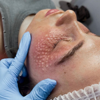 Аніта Татарова, Киев Фото - 5