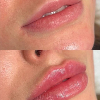 Аніта Татарова, Киев Фото - 6