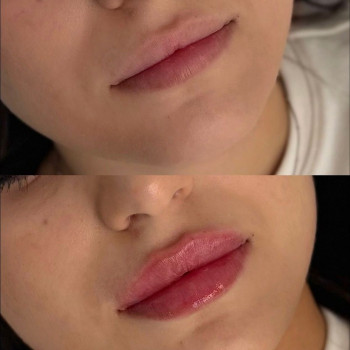 Аніта Татарова, Киев Фото - 9