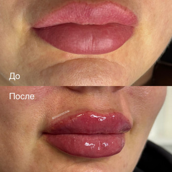 Аніта Татарова, Киев Фото - 10