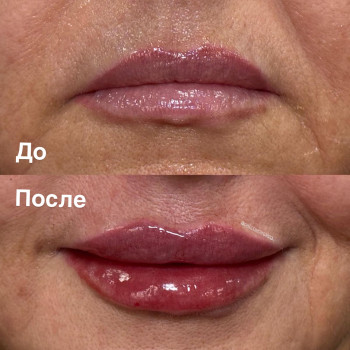 Аніта Татарова, Киев Фото - 11