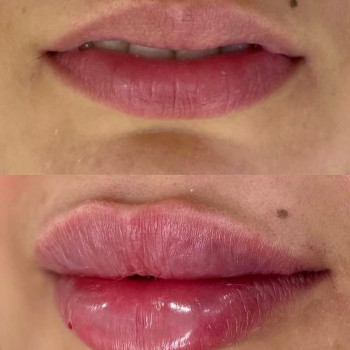 Аніта Татарова, Киев Фото - 12