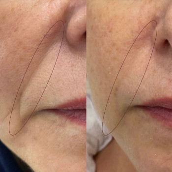 Аніта Татарова, Киев Фото - 13