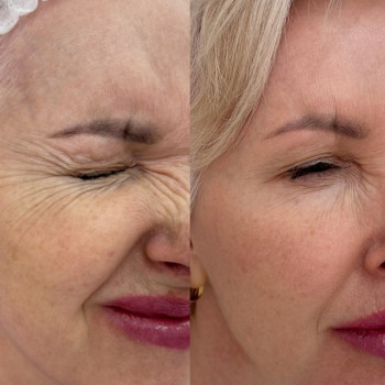 Аніта Татарова, Киев Фото - 14