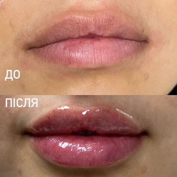 Аніта Татарова, Киев Фото - 15