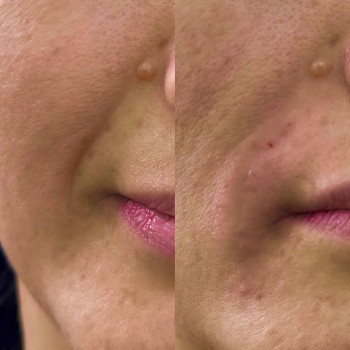 Аніта Татарова, Киев Фото - 17