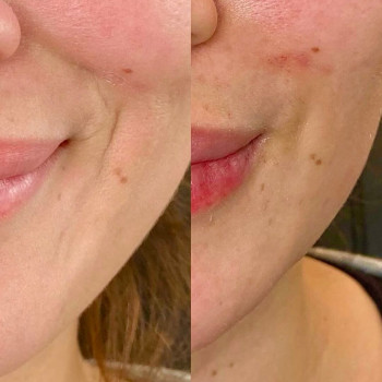 Аніта Татарова, Киев Фото - 18