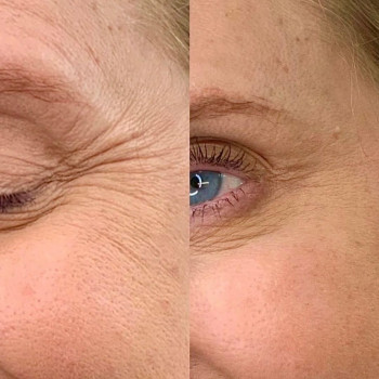 Аніта Татарова, Киев Фото - 19