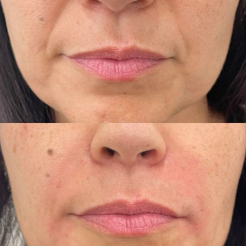 Аніта Татарова, Киев Фото - 20