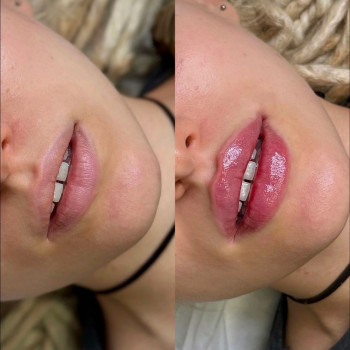 Аніта Татарова, Киев Фото - 21