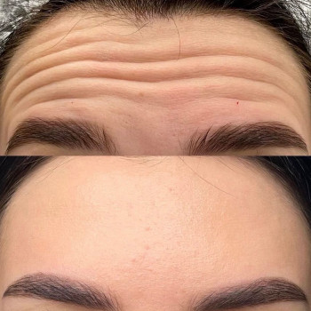 Аніта Татарова, Киев Фото - 22