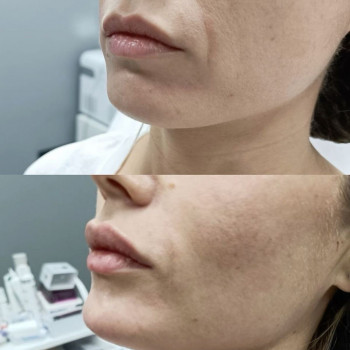 Аніта Татарова, Киев Фото - 23