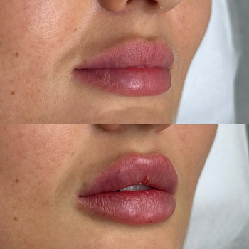 Аніта Татарова, Киев Фото - 25