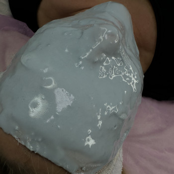 Накладання альгінатної маски