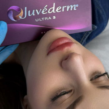 Анастасія Багінська, Київ Фото - 3