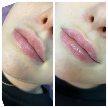 Алла Черняєва, Запоріжжя Фото - 11