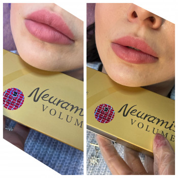 Алла Черняєва, Запоріжжя Фото - 12