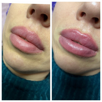 Алла Черняєва, Запоріжжя Фото - 14