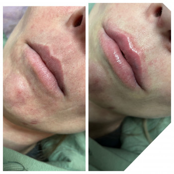 Алла Черняєва, Запоріжжя Фото - 17