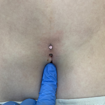 Пірсинг пупка