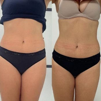 Body Studio, Могилёв-Подольский Фото - 5