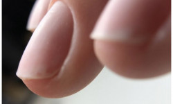 Гигиеничный маникюр Центры подологии Calutte Харьков