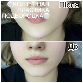 Юлія Стан, Кривой Рог Фото - 10