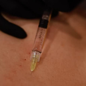 Ларіса Сагура, Полтава Фото - 5