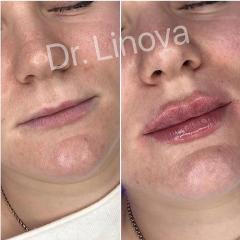 Він та Вона, Полтава Фото - 5