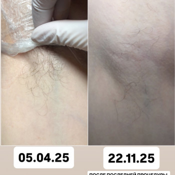 Світлана Московко, Київ Фото - 4