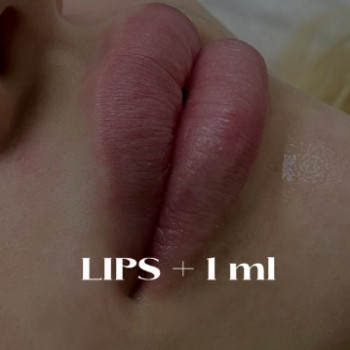 ViLite, Полтава Фото - 6