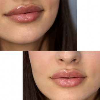 Алина Захарченко, Полтава Фото - 5