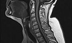 Мануальная терапия шейного отдела Мануальный терапевт Олег Киев